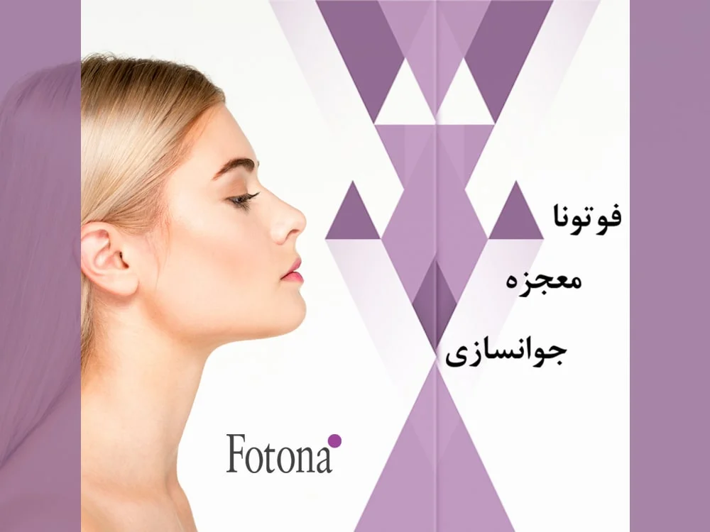 لیزر فوتونا
