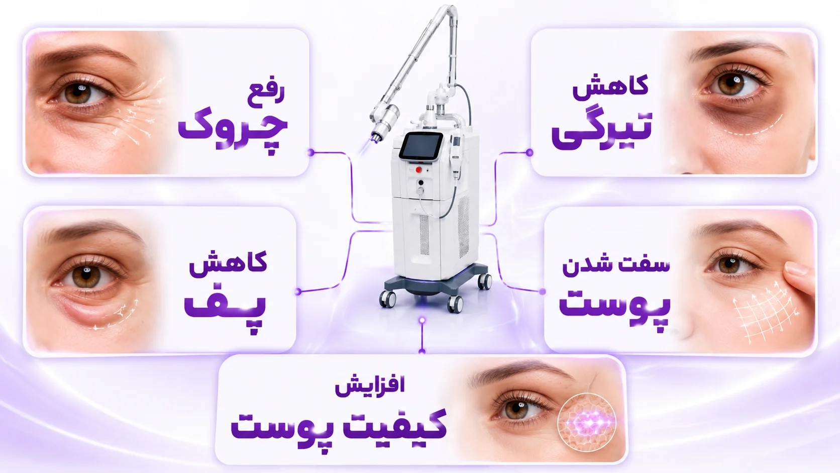 بررسی علت مشکلات پوست زیر چشم پیش از لیزر تصویر بررسی مشکلات پوست زیر چشم پیش از انتخاب لیزر