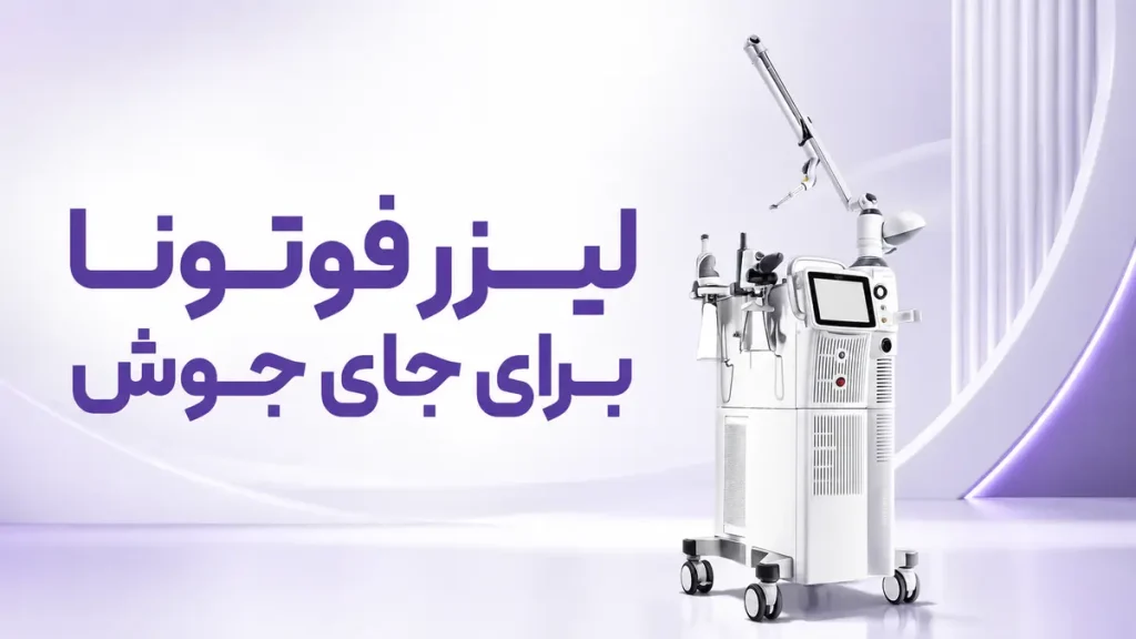 لیزر فوتونا برای جای جوش