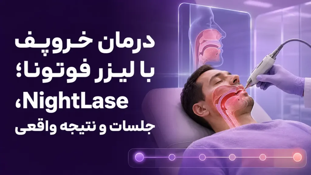 لیزر فوتونا دور چشم