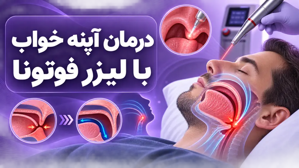 بررسی آپنه خواب پیش از جراحی خروپف تصویر بررسی آپنه خواب پیش از تصمیمگیری برای جراحی خروپف