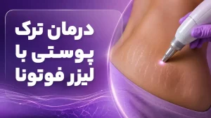 لاغری و تناسب اندام با لیزر فوتونا