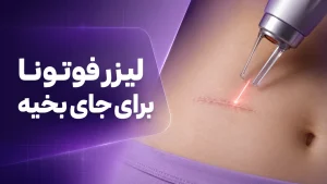 دستگاه فوتونا چیست