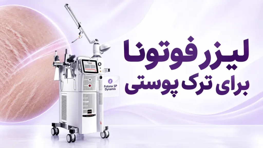 لیزر فوتونا برای ترک پوستی